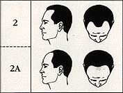 Scalp Micropigmentation Cost stage 2