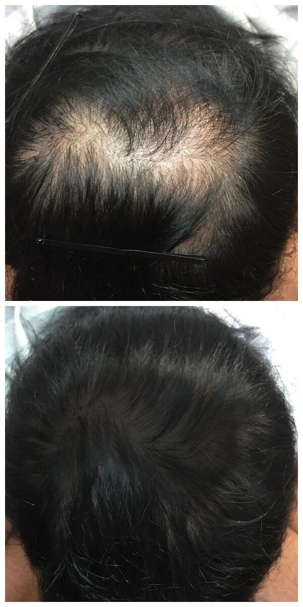 AC before and after AC before and after