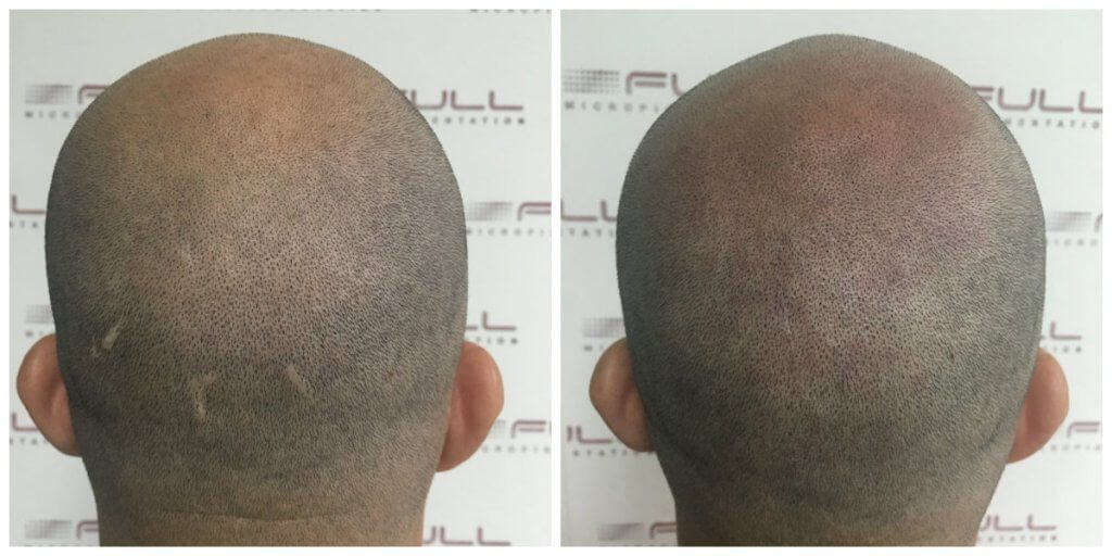 Cody - Before and After 2