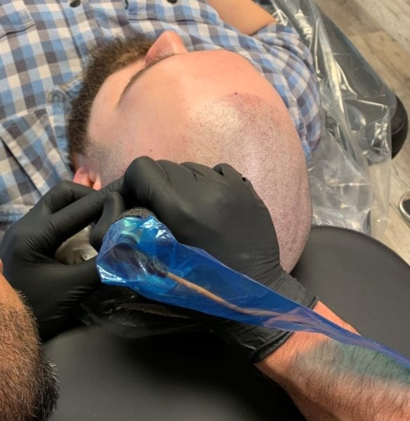 Scalp Micropigmentation - Las Vegas - 6176 Scalp Micropigmentation - Las Vegas - 6176