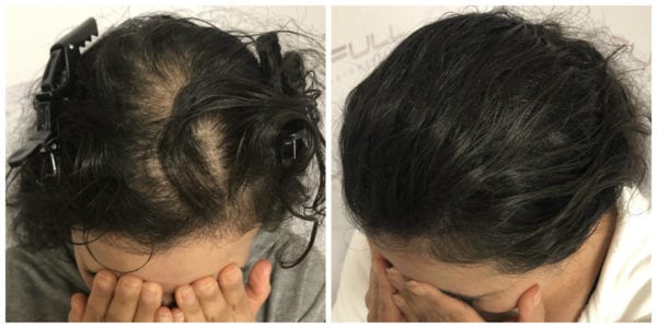 Client Valorie Before and After 2