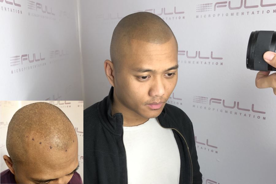 Ronen-Before-After-Testimonial Ronen-Before-After-Testimonial