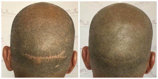 Luis-Before-After-3