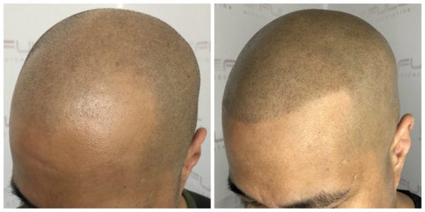 Mak-Before-After-2