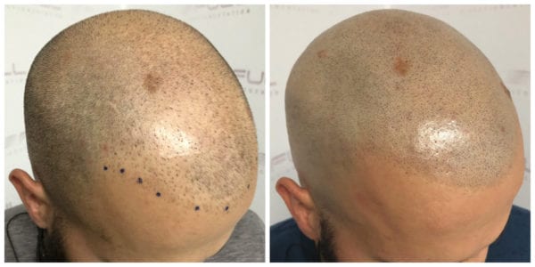 Kyle-Before-After-2