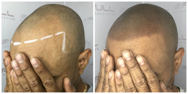 Ramon Before After 2