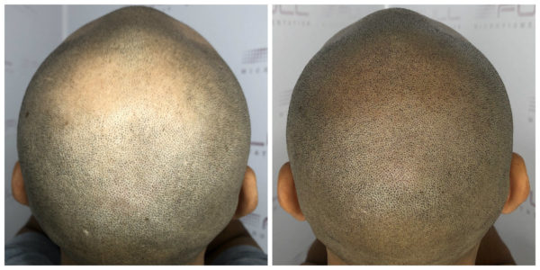 Ramon Before After 3