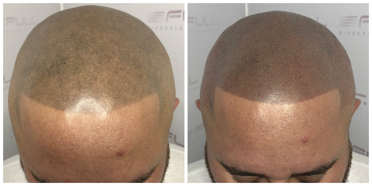 Hector Touch Up Before After 1