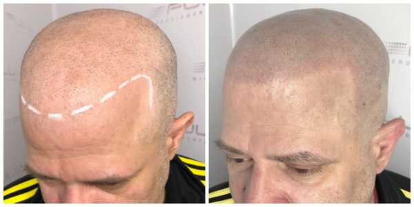 Ed Before After 1