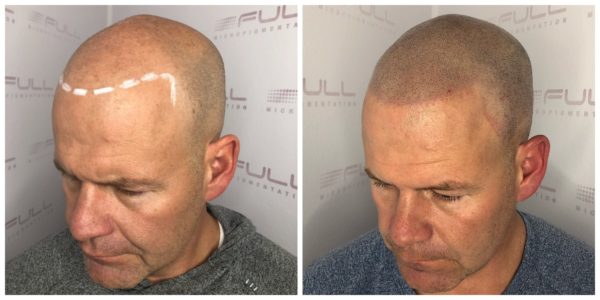 Steve Before After 1