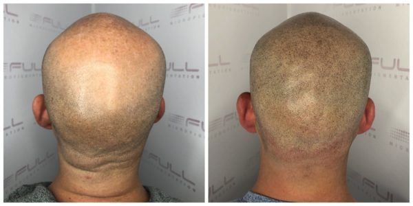 Steve Before After 3