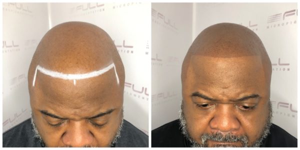Brian before and after 1