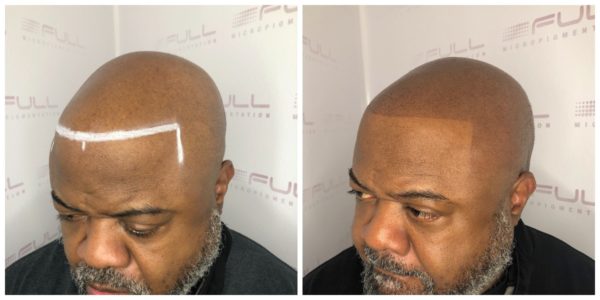 Brian before and after 2