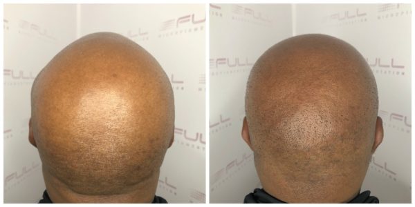Brian before and after 3
