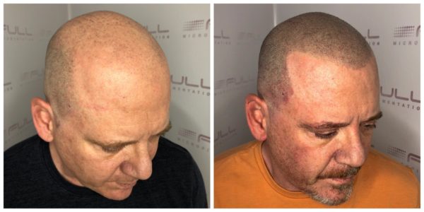 New Tom Before After 1