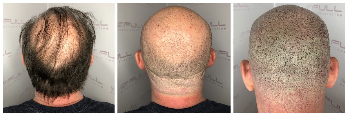 Tom New Healed Results 2 Tom New Healed Results 2