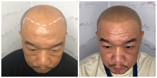 Thor Before After 1
