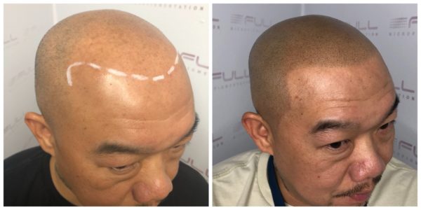 Thor Before After 2