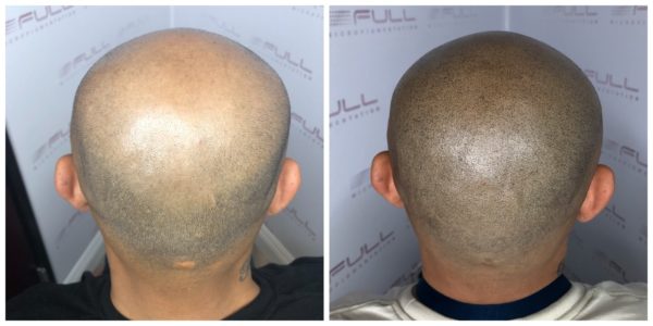 Thor Before After 3