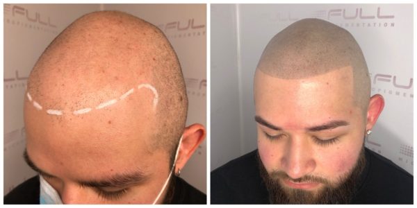 Romario Before After New 3