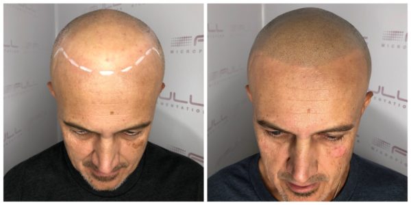 Troy Before After 1