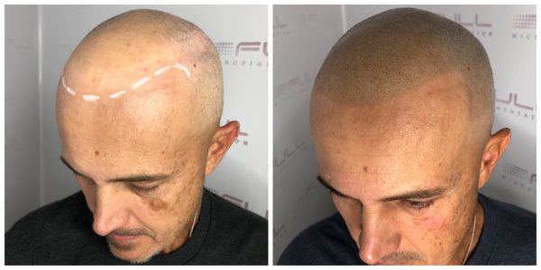 Troy Before After 2