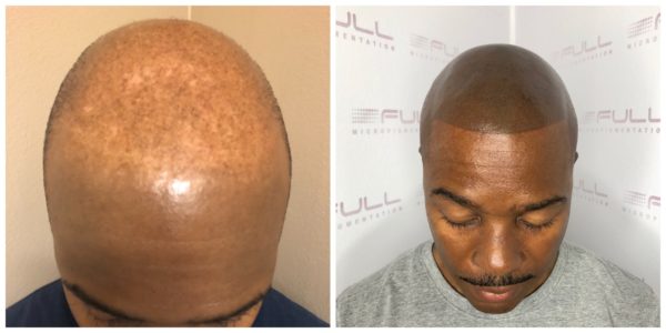 Matt Before After Final 1