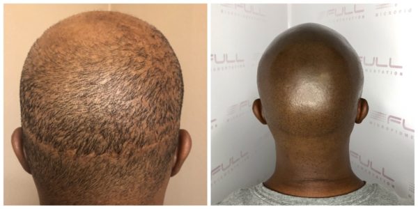 Matt Before After Final 3