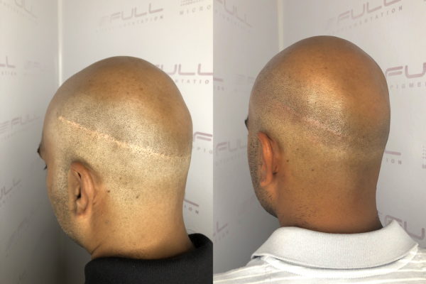 Sajith Before After 3