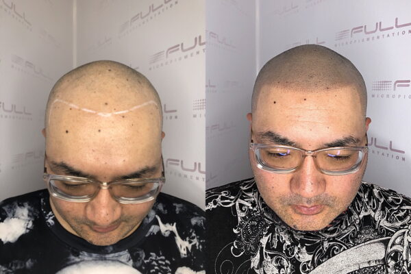 Toshi Before After 1