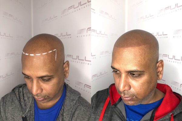 Donald 2 Before After 2