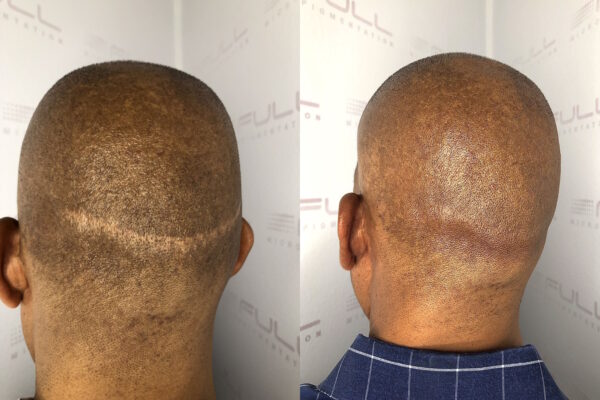 Client Brendon 3