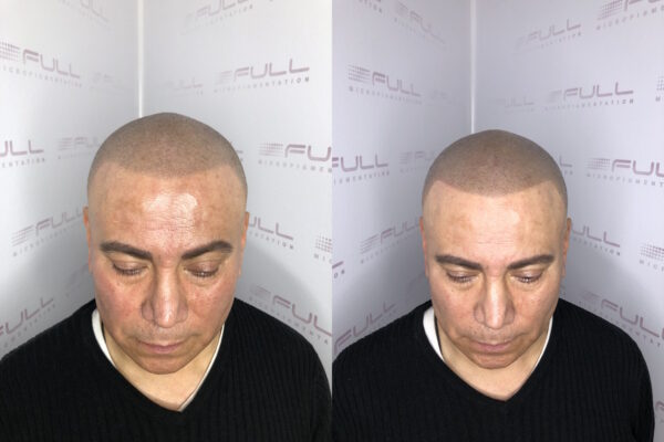 Jorge Touch Up Before After