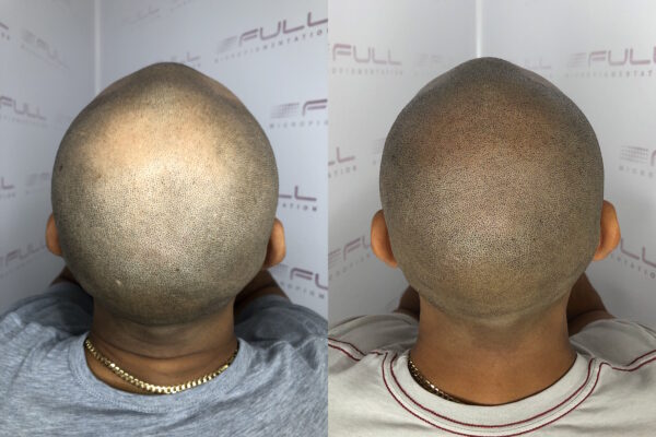 Ramon 2024 Before After 3