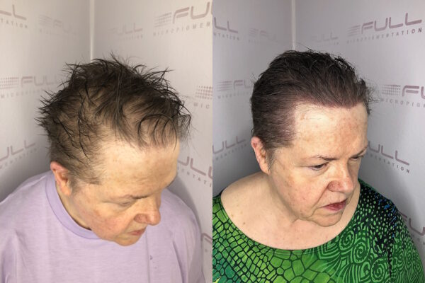 Rani Before After 3