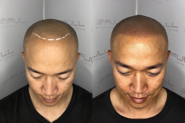 Steve 2 Before After 1