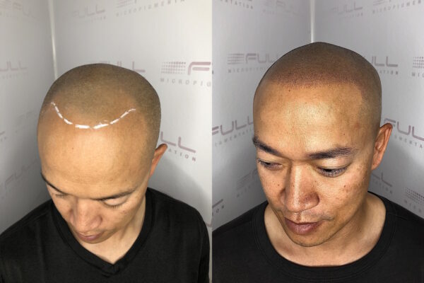 Steve 2 Before After 2